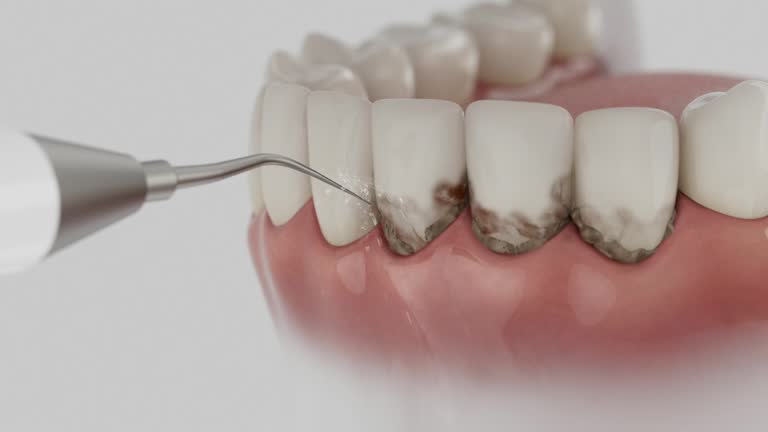 Reliable Dental Implants contractor in Rockville, MN by Smile Center Dentistry